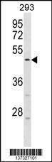 Anti-HORMAD1 (Center) Antibody
