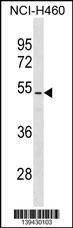 Anti-PTEN (Center T383/T382) Antibody