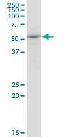 Anti-ENDOGL1 Antibody