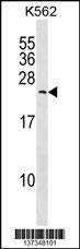 Anti-MYL6B (Center) Antibody