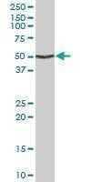 Anti-ENO1 Antibody