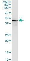 Anti-ENO1 Antibody
