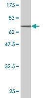Anti-ENO1 Antibody