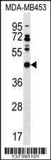 Anti-DNAJB5 (C-term) Antibody