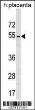 Anti-KIRREL2 (N-term) Antibody