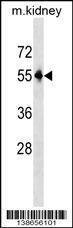 Anti-Mouse Pnpla3 (C-term) Antibody