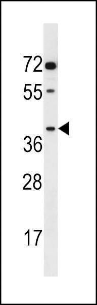 Anti-AKR1E2 (C-term) Antibody