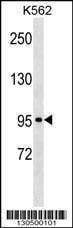 Anti-KIT (C-term S959) Antibody