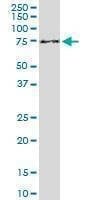 Anti-ENTH Antibody