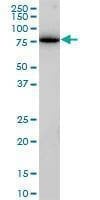 Anti-ENTH Antibody