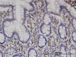 Anti-ENTH Antibody