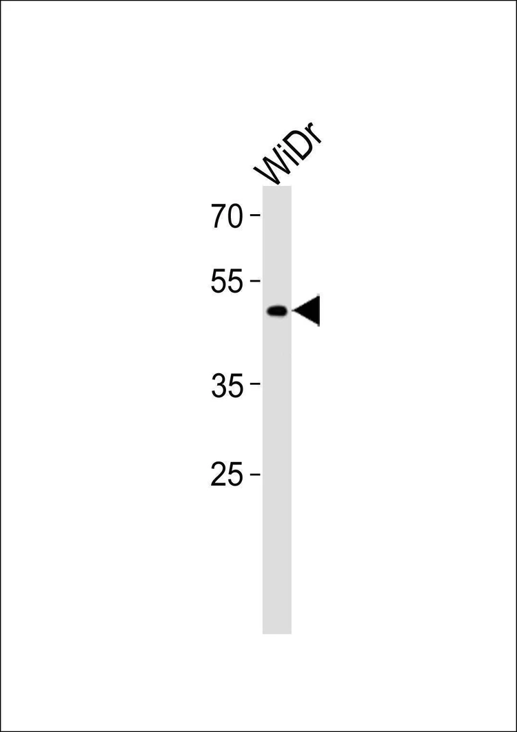 Anti-TFDP3 (N-term) Antibody