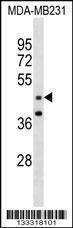 Anti-GRAMD3 (N-term ) Antibody