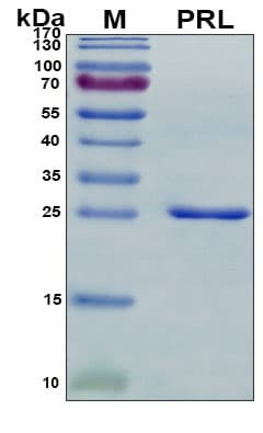 Recombinant Pig Prolactin Protein, Antigen Grade