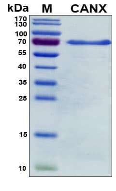 Recombinant Human Calnexin Protein