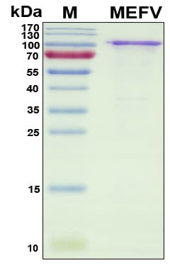 Recombinant Human Pyrin Protein, Antigen Grade