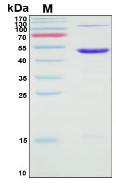Recombinant Streptococcus suis Extracellular Solute-binding Protein