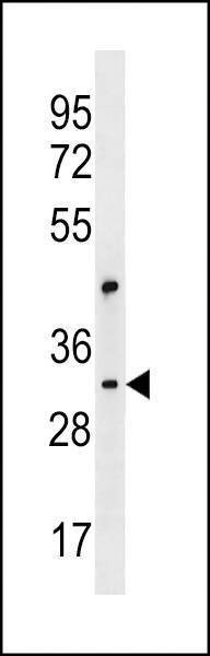 Anti-CEP170L (Center) Antibody