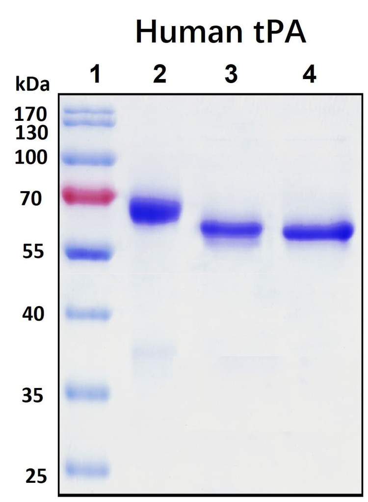 Recombinant Human t-PA Protein