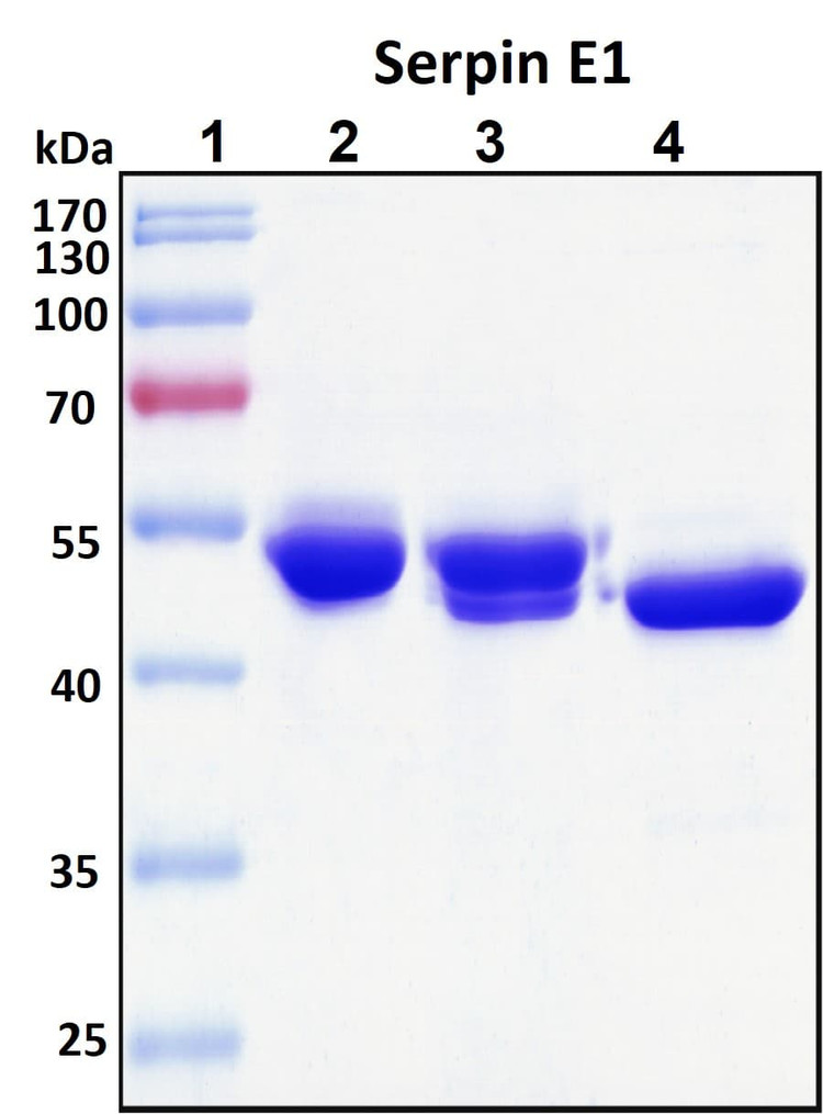 Recombinant Human PAI-1 (Serpin E1) Protein