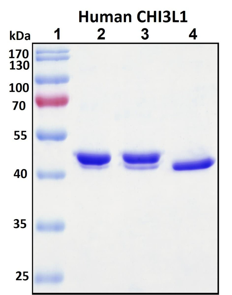 Recombinant Human Chitinase-3-like Protein 1 (CHI3L1)