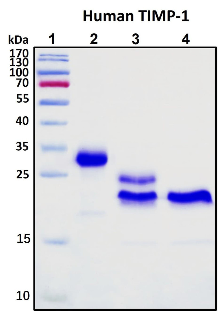 Recombinant Human TIMP-1 Protein