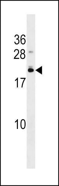 Anti-EFCAB10 (C-term) Antibody