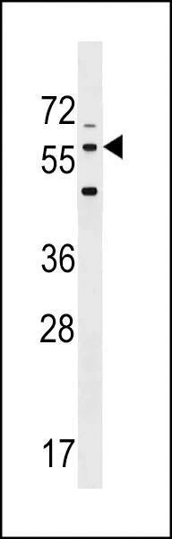 Anti-LRRTM2 (C-term) Antibody