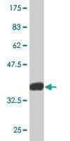 Anti-EPB41L1 Antibody