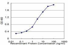 Anti-EPB41L1 Antibody