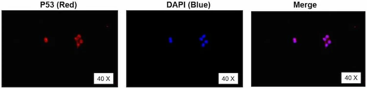 Anti-P53 (2-29aa) Antibody