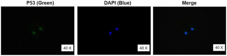 Anti-P53 (176-200aa) Antibody