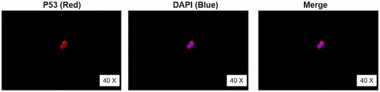 Anti-P53 (176-200aa) Antibody