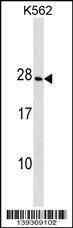 Anti-CRYGD (Center) Antibody