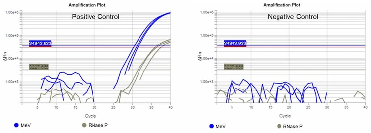 Measles Virus Real Time RT-PCR Detection Kit