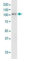 Anti-EPHA3 Antibody