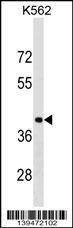 Anti-PCBP1 (Center) Antibody