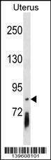 Anti-PCDHGB4 (Center) Antibody