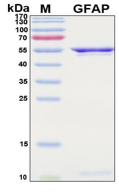 Recombinant Human Glial Fibrillary Acidic Protein (GFAP), Antigen Grade