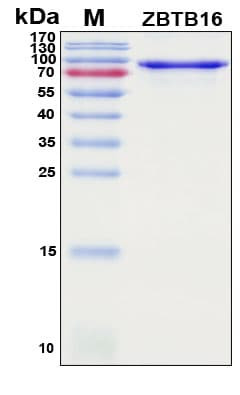 Recombinant Human Zinc Finger Protein 145, Antigen Grade