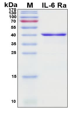 Recombinant Porcine (Pig) IL-6 RA Protein, Antigen Grade