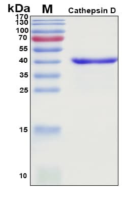 Recombinant Porcine (Pig) Cathepsin D Protein, Antigen Grade