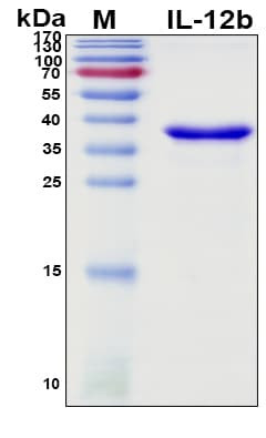Recombinant Porcine (Pig) IL-12 beta (p40) Protein