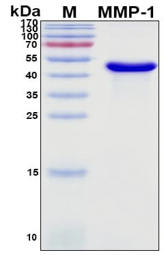 Recombinant Porcine (Pig) Interstitial Collagenase (MMP-1) Protein
