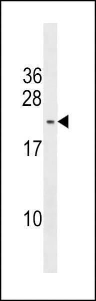 Anti-PMS2L5 (C-term) Antibody