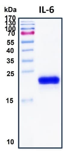 Recombinant Human IL-6 Protein, HEK293
