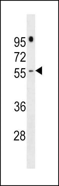 Anti-PRAMEF16 (C-term) Antibody