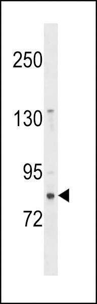 Anti-ZNF853 (N-term) Antibody