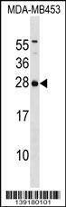 Anti-ITPA (C-term) Antibody