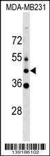 Anti-MLC1 (C-term) Antibody